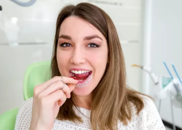 Discovering the Best in Clear Braces: The Benefits of Invisalign